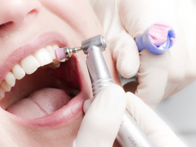Комплексная профессиональная чистка зубов – 3500 руб.