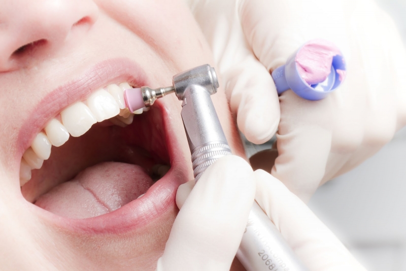 Комплексная профессиональная чистка зубов – 3500 руб.